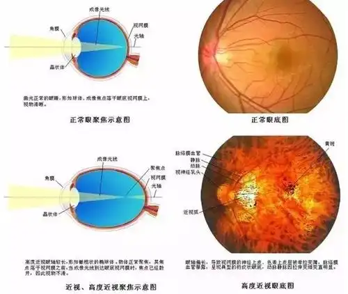 出来玩表情包眼底病变