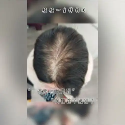 产后掉头发发福是不是不会眷顾每一个宝妈呀,我掉头发养好了,被减肥难住了,这可怎么办呀 产后掉头发发福是不是不会眷顾每一个宝妈呀,我掉头发养好了,被减肥难住了,这可怎么办呀