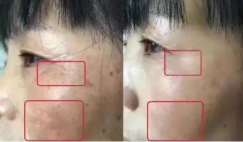  熬夜肌肤状态差这款能隐形的面膜,20分钟恢复水润肌肤