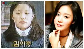  世界一美nana为整容前旧照图揭韩国人造女星