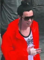  张艺谋现身新片片场小沈阳戴假发套带伤露面