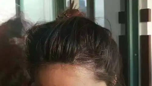  秃头女孩的变美日记