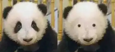 一直摆脱不了的黑眼圈,果真只是因为熬夜