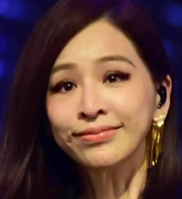  那些被玻尿酸毁掉的女星,娄艺潇画风跑偏,最后一位像毁容