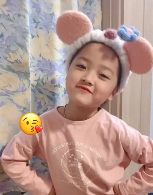  还记得表情包女孩权律二曾经可爱迷人,如今却成秃头妹
