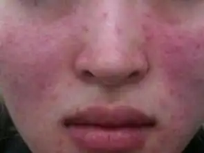 问对方在干嘛的表情包玫