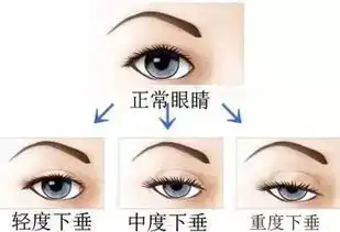 溜了表情包素材贴双眼皮