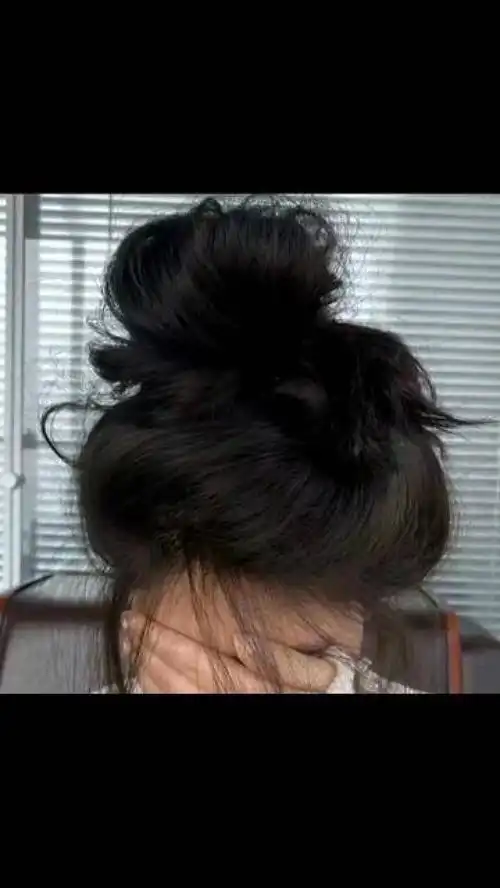  幸好听了妈妈的话,不然每次洗头掉几十根真的会变成贝勒爷秃头少女