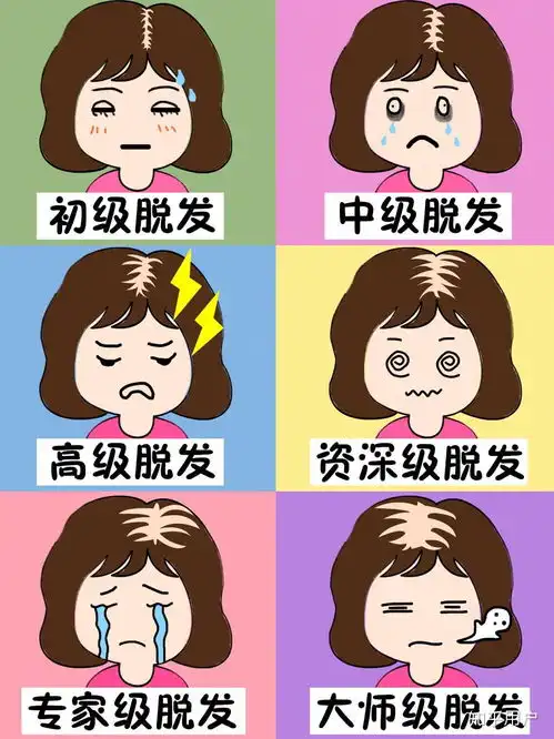  非遗传性脱发可以治愈吗