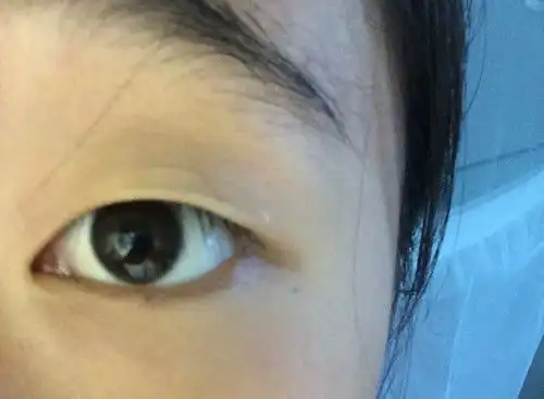 一下是我用了双眼皮贴前后的样子,撑起来之后再一闭眼就不是双眼皮了求解应该怎么贴 一下是我用了双眼皮贴前后的样子,撑起来之后再一闭眼就不是双眼皮了求解应该怎么贴