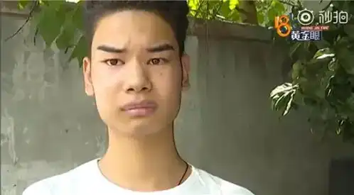  杭州发际线男孩小吴拍广告了