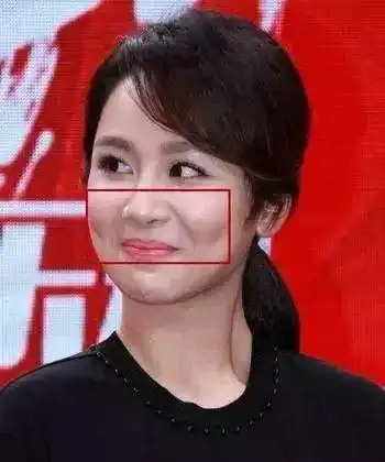  脂肪填充担心肿胀学杨紫这样就很聪明了