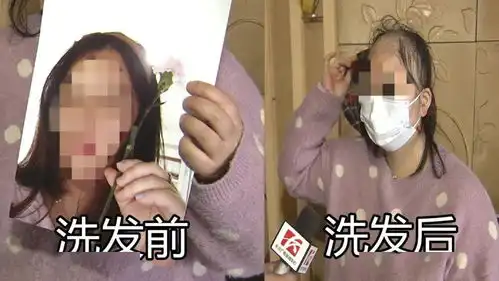  女子从养发馆出来后变秃头店家这么回应