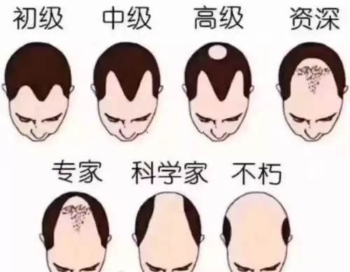  会计专业程序员及设计师等级pk表对应秃头指数,注会竟然输给了它