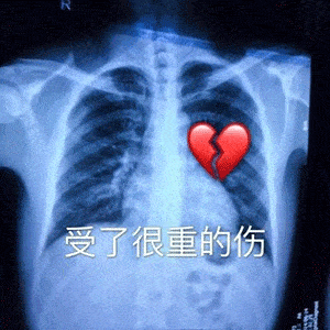  沙雕表情包你接着说,我保证左耳朵进右耳朵出