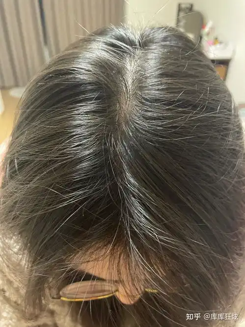  秃头女孩的本命洗发水终于还是让我找到了