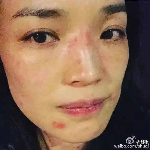  原来范冰冰也嫌lamer,lp太贵有它在一样能去痘印,白出天际