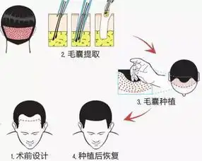  90后脱发你不是一个人,这个秘籍你好好收藏一下颜值master